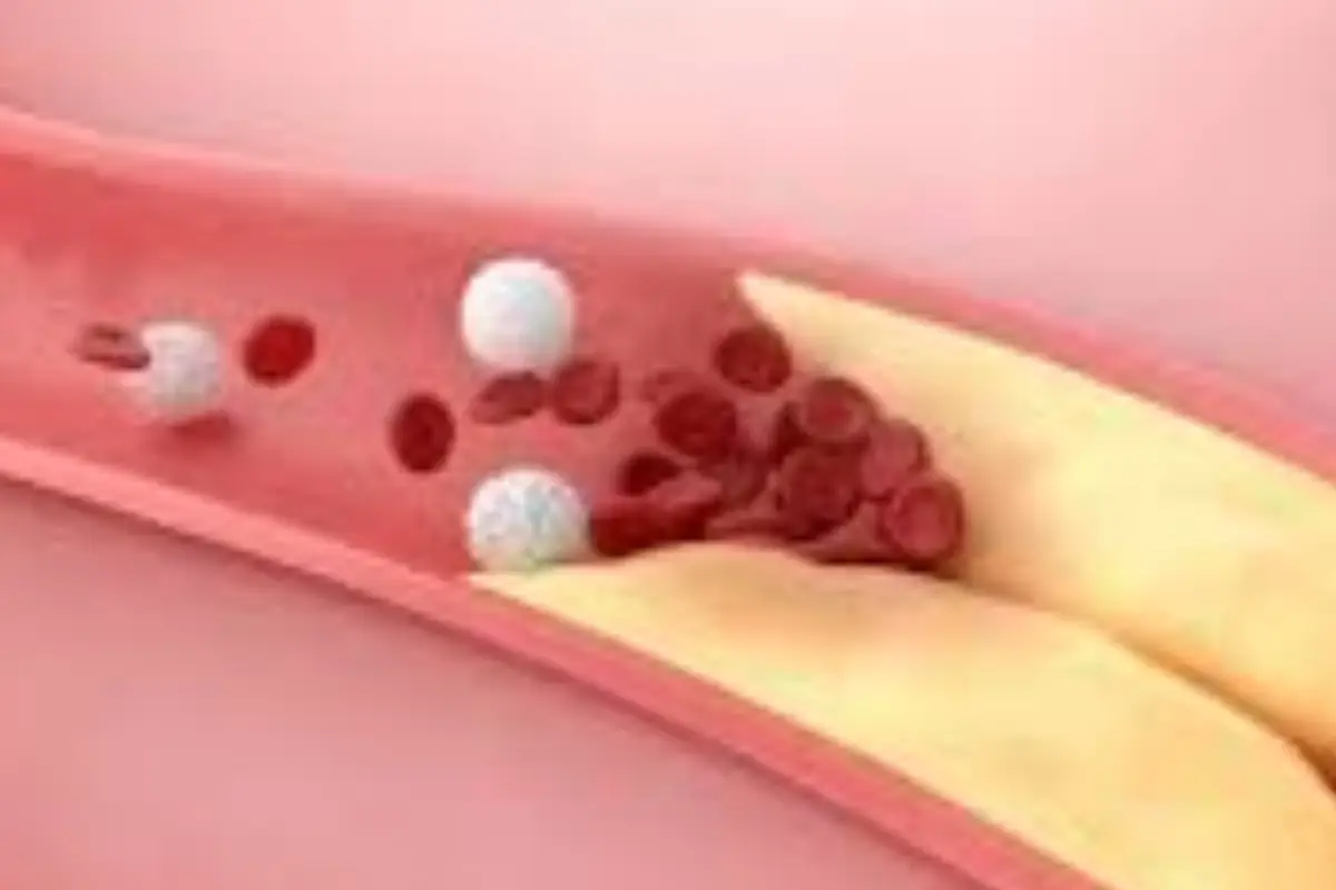 Immagine selezionata